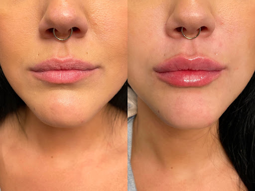 Bespoke Aesthetics and Wellness