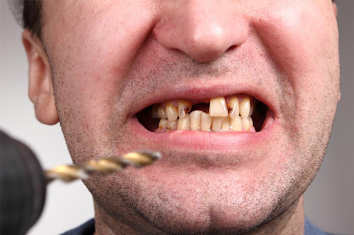 Woodbury Park Dental Surgery Tunbridge Wells - Thumbnail