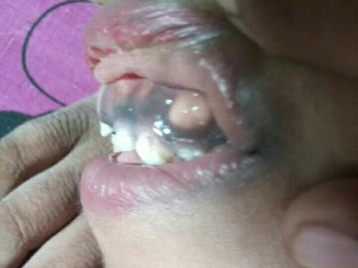Cured within 7 days (Dr Soumya Dey's Clinic desk)  post image