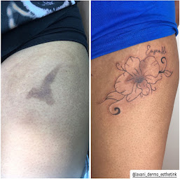 Photo n°11 de Lavani dermo esthet'ink à Chevannes (Clinique de maquillage permanent)