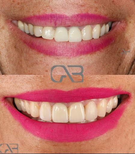 CAB Rehabilitacion oral e implantes