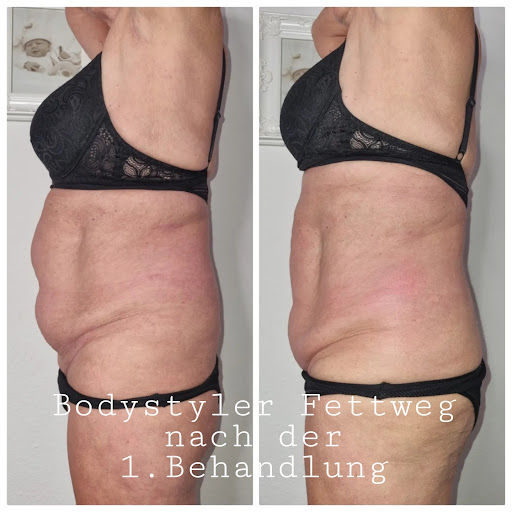 Beauty Balance Cosmetic & more Zahnbleaching Julia Glasmacher - Thumbnail