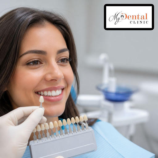 Dreaming of a brighter, perfectly aligned smile without long treatments? At My Dental Clinic - Dr… post image