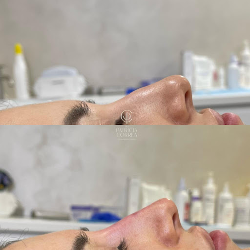 Dra Patricia Correa | Clínica de Medicina Estètica Gallery - Spain