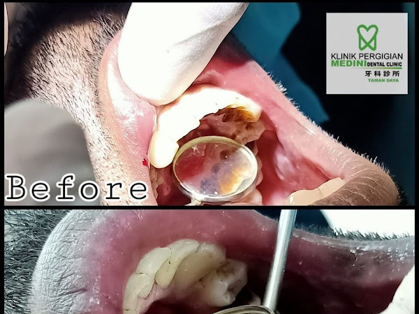 Klinik Pergigian Medini Taman Daya