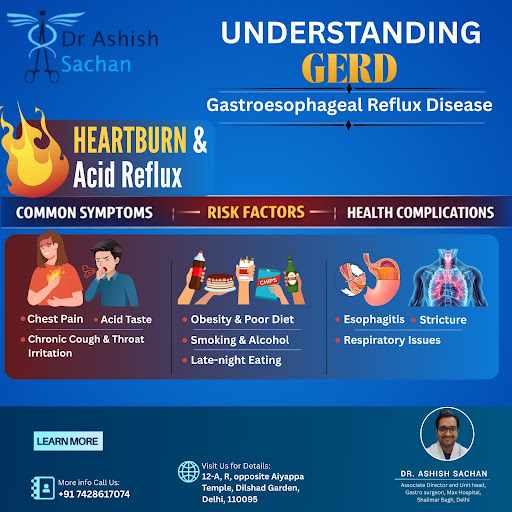 GERD (Gastroesophageal Reflux Disease) causes uncomfortable heartburn and acid reflux that can af…