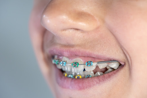 Searching for a trusted dental clinic for a better-aligned smile? Cureway Smile Studio. Dental, I… post image