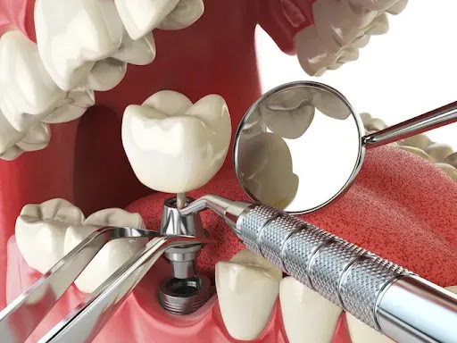 Orion's Dental: Dentist in Springvale - Thumbnail