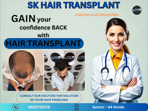 Looking for the best hair transplant in Delhi NCR? Visit SK Hair Transplant, a trusted name in ha…