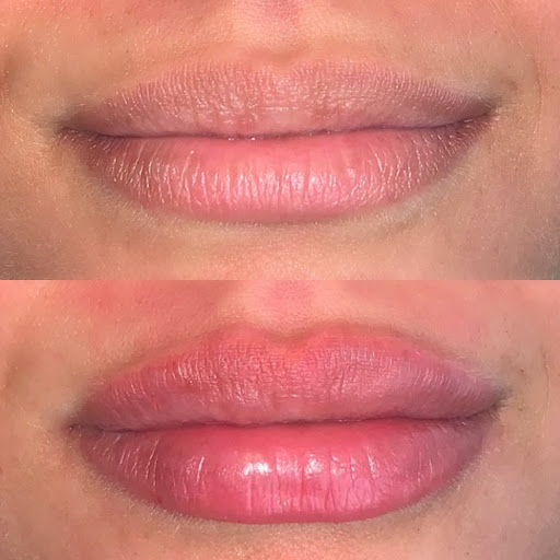 Pure Skin MedSpa of Trumbull