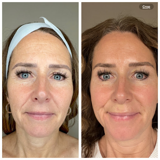 Bright Beauty Medspa - Thumbnail