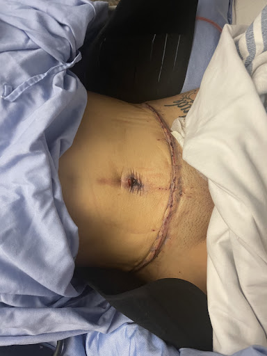 Dr Anzarut Plastic Surgery - Thumbnail