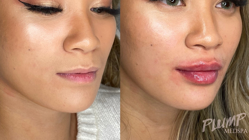 Plump Medspa - Visual