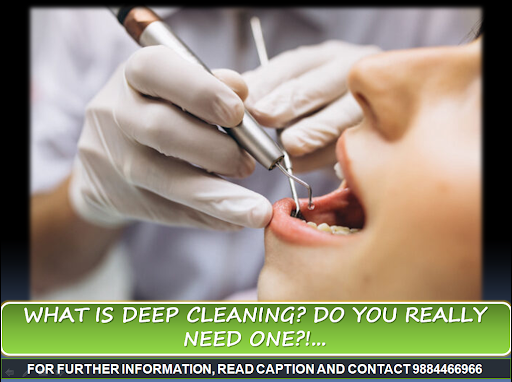 A deep cleaning, also called gum scaling or root planing, removes plaque and tartar beneath the g…