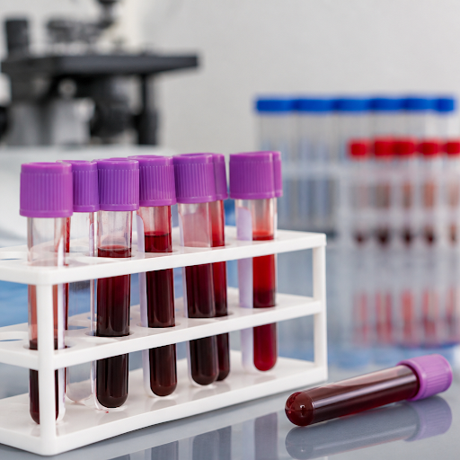 A simple CBC test can tell a lot about your health long before symptoms appear. At R T Pathology… post image