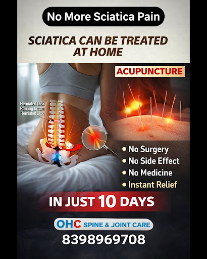 : “Beat Sciatica Pain Naturally with Acupuncture – No Surgery, No Medicine!” post image