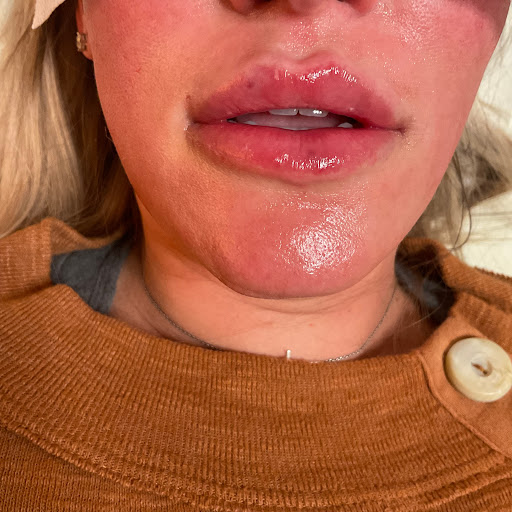 Aesthetic Essentials of Augusta, LLC