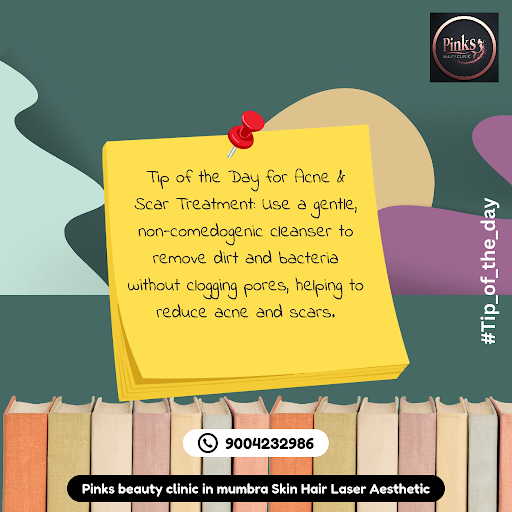 Tip of the day! post image