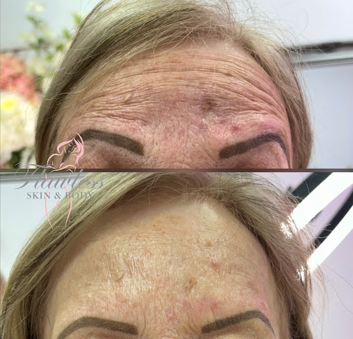 Flawless Skin & Body - Basingstoke