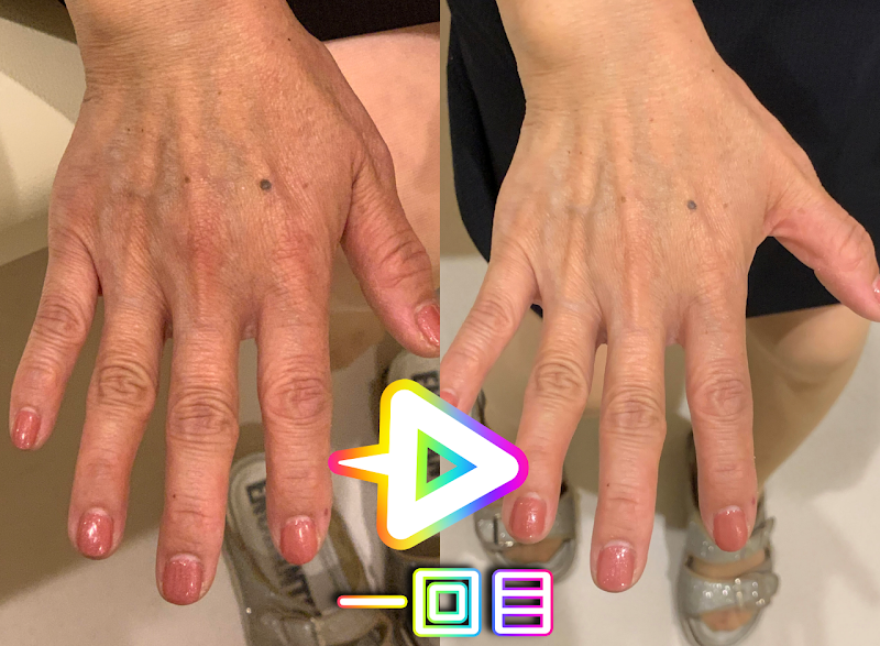 脱毛＆光エステ one-shot（ワンショット）