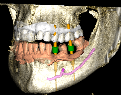 Studio Dentistico Crisetti - Thumbnail