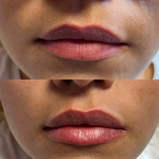 Unfiltered Aesthetics