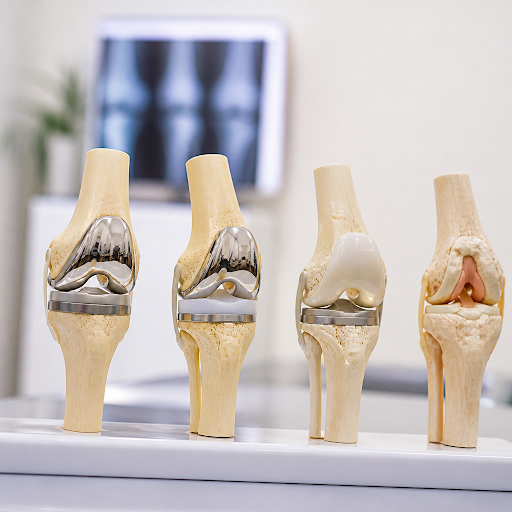 Living with constant knee pain can stop you from enjoying simple daily activities. At Dr Zeeshan… post image