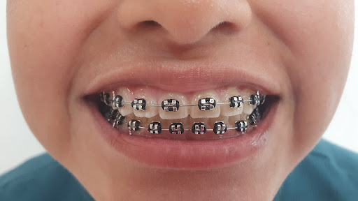Rosedent Implant & Dental Care | Clinica dental | Logo