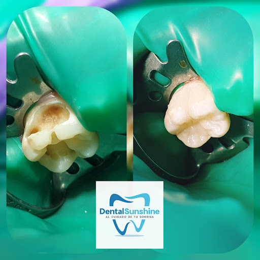 Dental Sunshine Gallery - Mexico