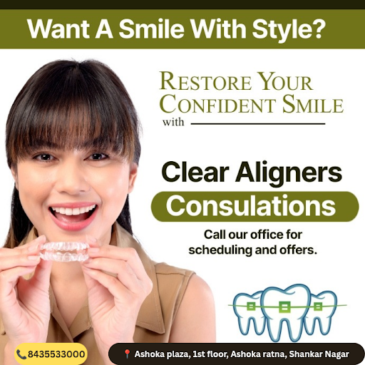 Consult our specialist team for advance treatment of clear aligners post image