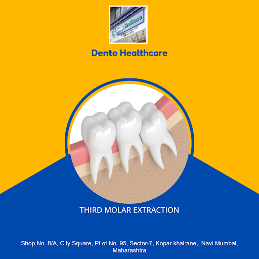 Looking for painless third molar extraction? Visit Dento Healthcare in Navi Mumbai for the best d… post image