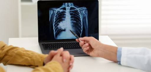 Best Chest Specialist in Jaipur