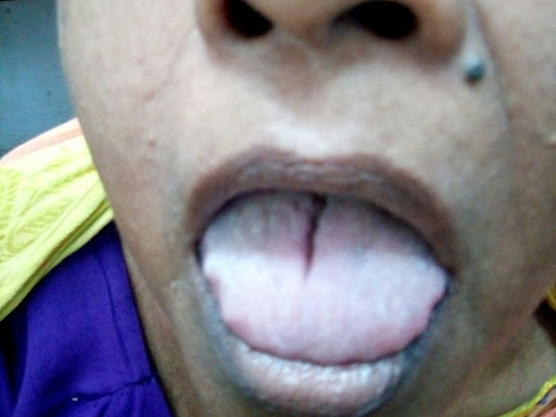 Cured within  3 weeks (Dr Soumya Dey's Clinic desk)  post image