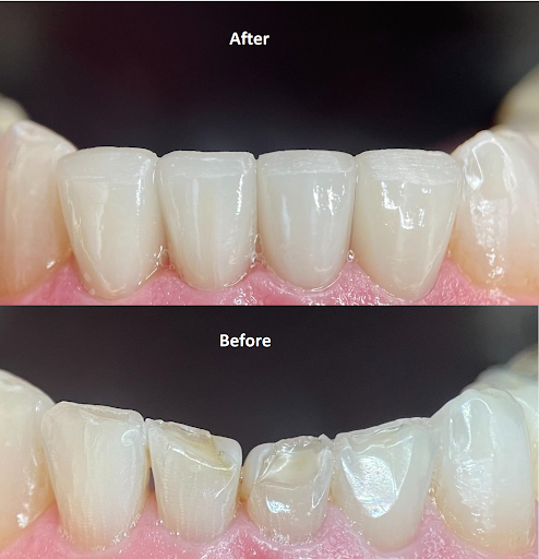 Laurel Smiles Dental Care