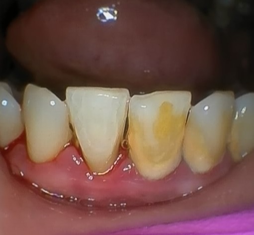 H&G Dental - Thumbnail