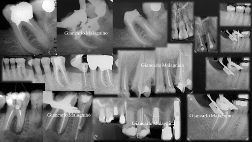 Endodonticamente - Visual