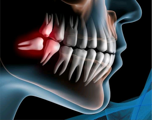 Dental's Guadalupe Sucursal Bellavista - Thumbnail