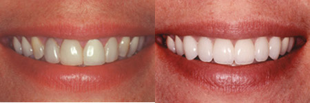 Parkdale Family Dental