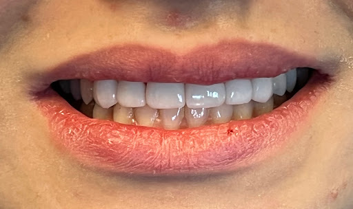 Modesto Dentistry And Implants Gallery - United States