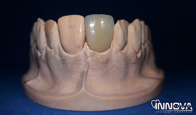 Photos of Innova Dental Art