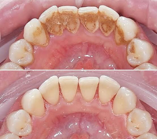 Consultorio dental DentalXpert - Thumbnail