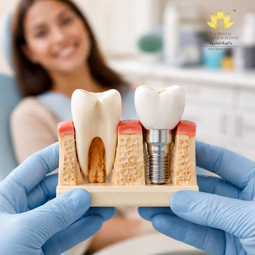 Missing teeth do more than affect your smile – they can slowly weaken your jawbone and change you… post image