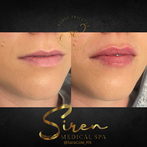 Siren Medical Spa - Thumbnail