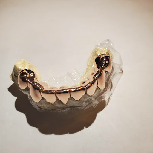 Custom Grillz Fl - Thumbnail