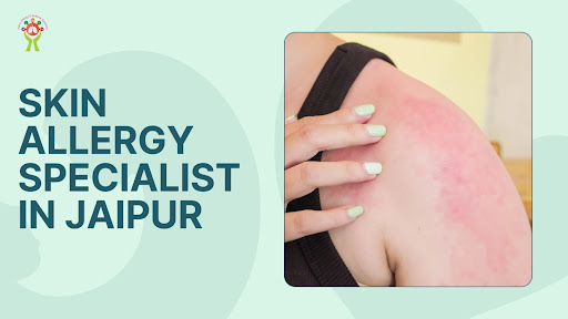 Consult the best skin allergy specialist in Jaipur for effective…