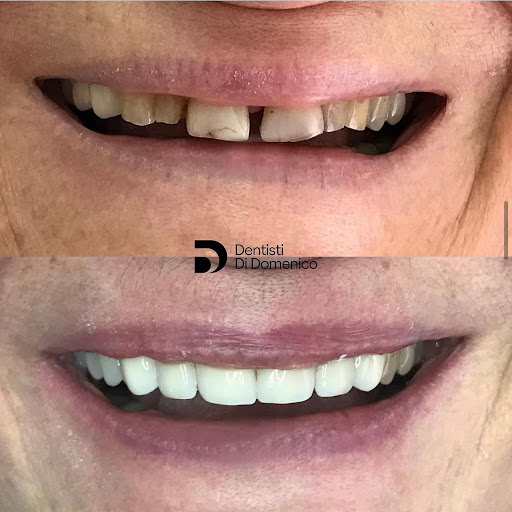 DENTISTA FRATTAMAGGIORE (Dott. Di Domenico Antimo) - Thumbnail