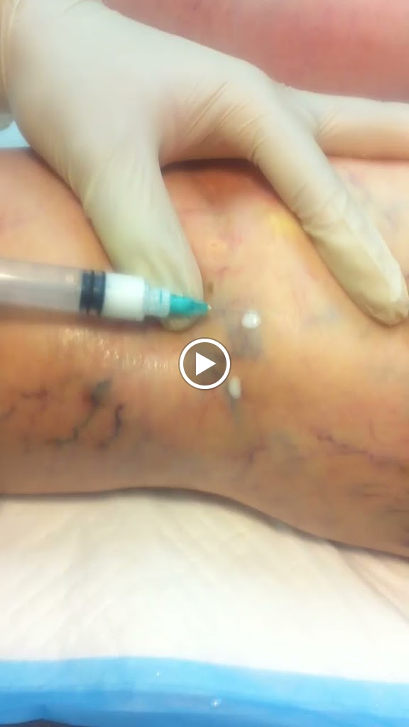 Thatipelli Mallik Md Rvt