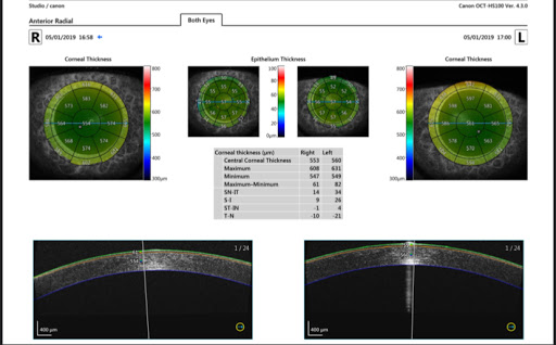 Centro Diagnosi Oculare - Thumbnail