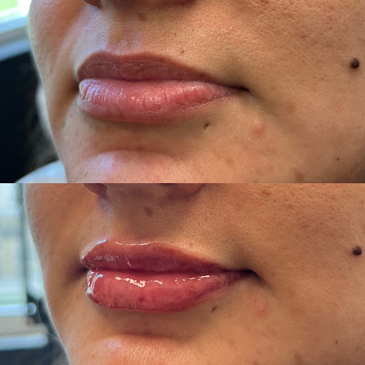 Glo & Glam Viridian - MedSpa & Skin Care