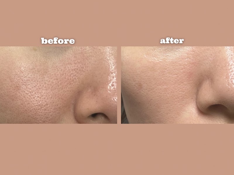 毛穴ケア専門サロン LINDEZA【リンデザ】